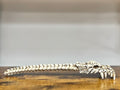 Back Scratchers